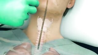 Bronchoscopy Procedure For Lung Biopsy 3D Animation