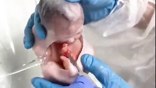 Born children doctor  Operation