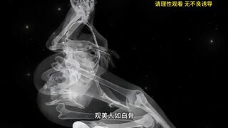 If you've used x-rays, then this is
