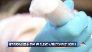 Health Officials Warn Of Potential HIV Risk After Vampire Facial At New MX Spa | NBC Nightly News