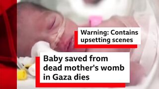 Baby saved from dead