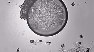 Just a little tardigrade scratching its back on a bubble.