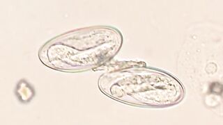Ova of E vermicularis under microscopic visualization