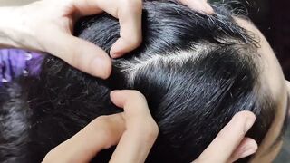 Lices nits picking scalp close to black shiny hair