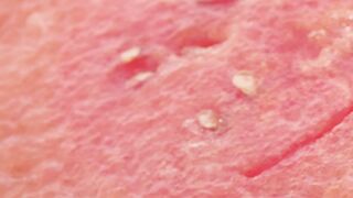 Fresh watermelon cut into parts