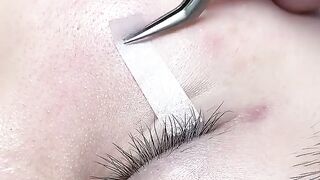 Face treatment