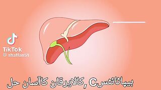 Hepatitis C kala yarkan ka asan hal