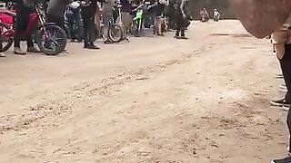 The boy wins the race despite the bike catching fire