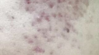 Skin care must watch