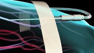 How Medicine Get Absorbed