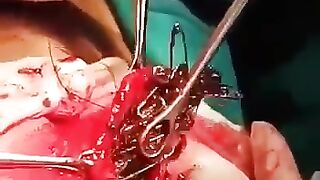 ایک لڑکی جو کہ سیفٹی پن کھانے لگ گئی تھی