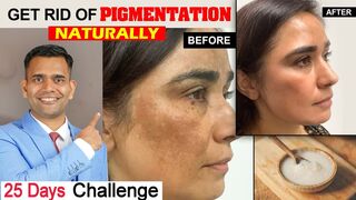 25 Days Challenge Get Rid Of Pigmentation, melasma Naturally