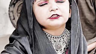 Sr dard ????