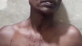 পটিয়ায় হামলায় আহত