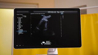Ultrasound scan on a monitor - adalinetv