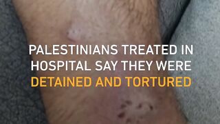 Palestinians say they were detained and tortured for 50 days by Israeli forces