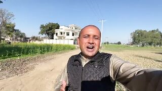 Hair Transplant Result After 13 Days | Mubashir Saddique | Village Food Secrets