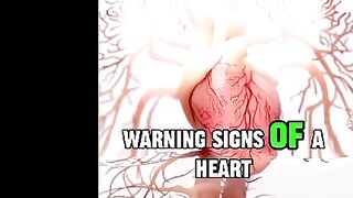 This is how Heart Attack Happens........