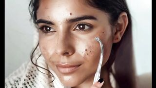 Claims to eliminate acne with electric shocks on the face