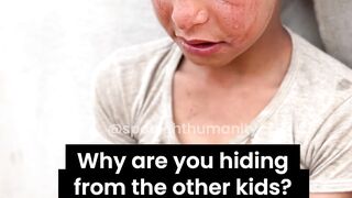 We found him hiding from the other children for the saddest of reason ???? #fyp  #sad