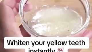Whiten Your Yellow Teeth with Natural Remedy