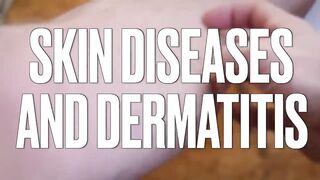 The MOST Common Deficiency in All Skin Diseases (Dermatitis)
