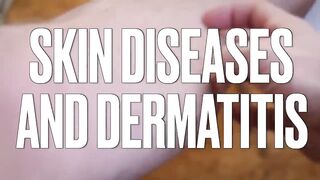 The MOST Common Deficiency in All Skin Diseases (Dermatitis)