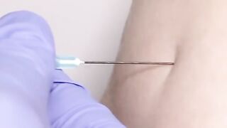 Human... Skin .. infection
