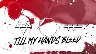 NEFFEX - Till My Hands Bleed ???? [Copyright Free] No.170