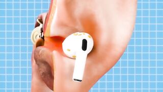 Why your earbuds are gross????