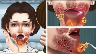 Asmr face infection animations video