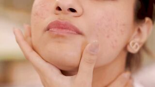 I want to share something that’s made a HUGE difference in my skincare journey.