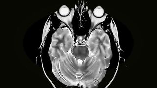 Health - What happens to your brain as you age Watching and Subscribed