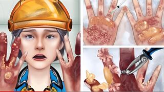 Asmr hand infliction animation video