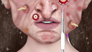 Full face surgery