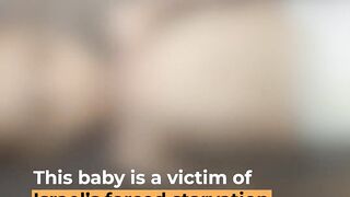 Israel’s forced starvation in Gaza has killed dozens of children | Al Jazeera Newsfeed