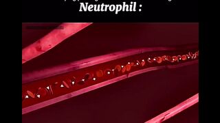 Tahukah kamu, Neutropniis adalah sejenis sel darah putih yang berperan penting dalam respon imun tubuh terhadap infeksi.