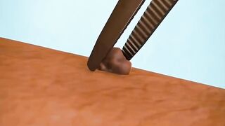 Skin warts are caused by various strains of human papillomavirus.