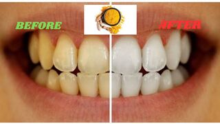 UNLOCK A BRIGHTER SMILE: The Secret Benefits of Turmeric For TEETH WHITENING