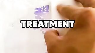 Lawyer tries to outsmart doctor