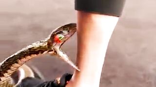 Snake Bite Symptoms: Know the Signs