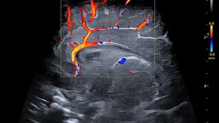 Ultrasound 2