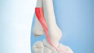 The Unsung Hero: Your Thumb's Hidden Muscle