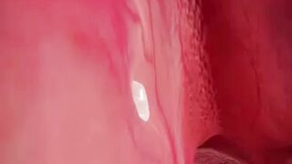 Yikes! Can Teeth Really Grow in Your Nose?