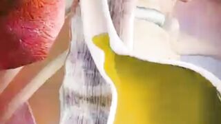Tummy Trouble: The Burning Truth About Acid Reflux