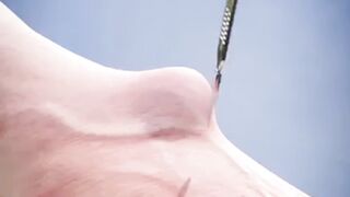Beyond the Bump: Your Guide to Treating and Removing Ganglion Cysts