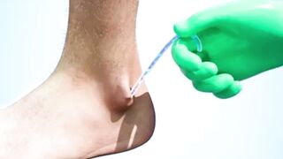 Beyond Blisters: The Horrifying Life Cycle of the Guinea Worm