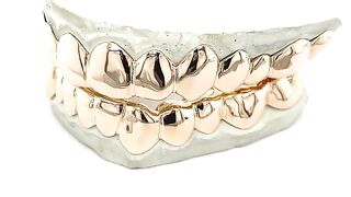 Real Gold Full Wall High Polish Grill