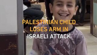 A Palestinian child recounts losing his arm while he was playing football with his friends. 2