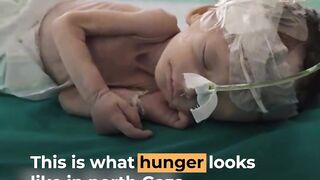 Extent of forced hunger crisis in Gaza revealed in UN report | Al Jazeera Newsfeed